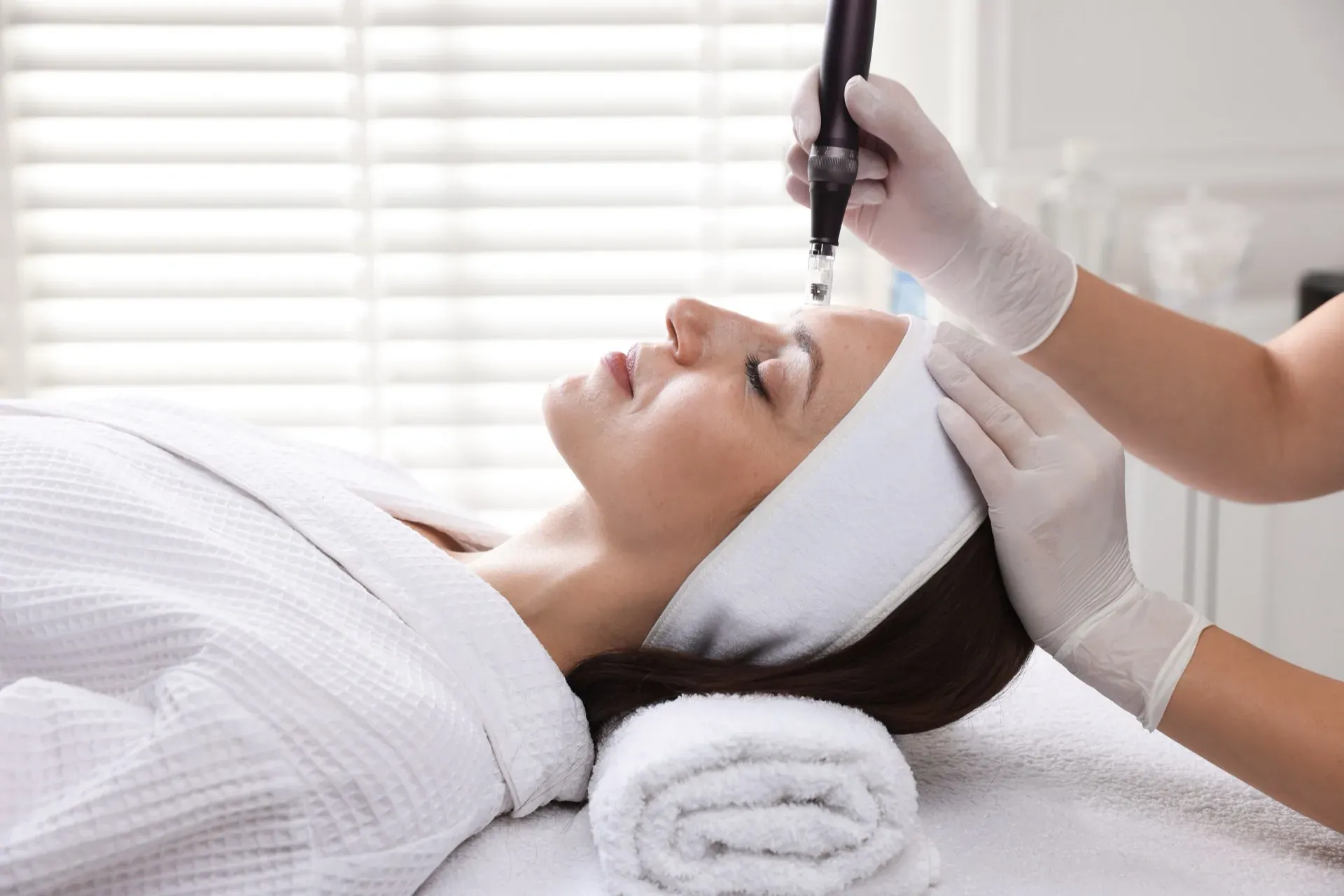 Microneedling